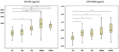 CSF-Progranulin and Neurofilament Light Chain Levels in Patients With Radiologically Isolated Syndrome—Sign of Inflammation